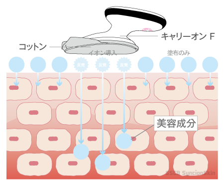 セルフイオン導入器CARRION F キャリーオンF 専用 プレミアムコットン